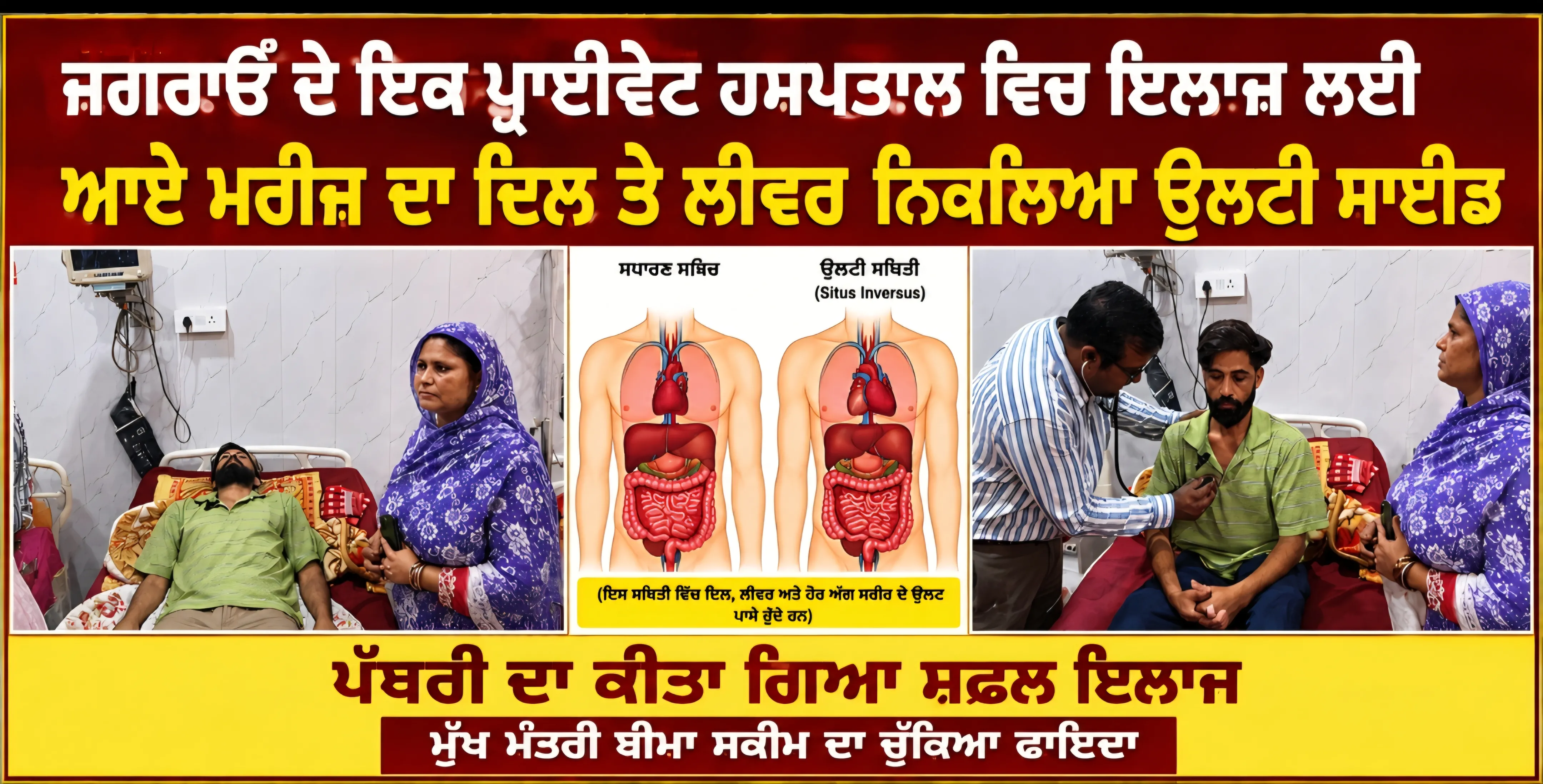 ਜਗਰਾਓਂ: ਬਲਜੀਤ ਸਿੰਘ ਵਾਸੀ ਜੱਸੋਵਾਲ ਕਲੇਰ ਨਾਮਕ ਮਰੀਜ਼ ਜਿਸਦਾ ਦਿਲ ਸੱਜੇ ਪਾਸੇ (Dextrocardia) ਅਤੇ ਲੀਵਰ ਖੱਬੇ ਪਾਸੇ ਹੈ, ਜਿਸਨੂੰ Situs I