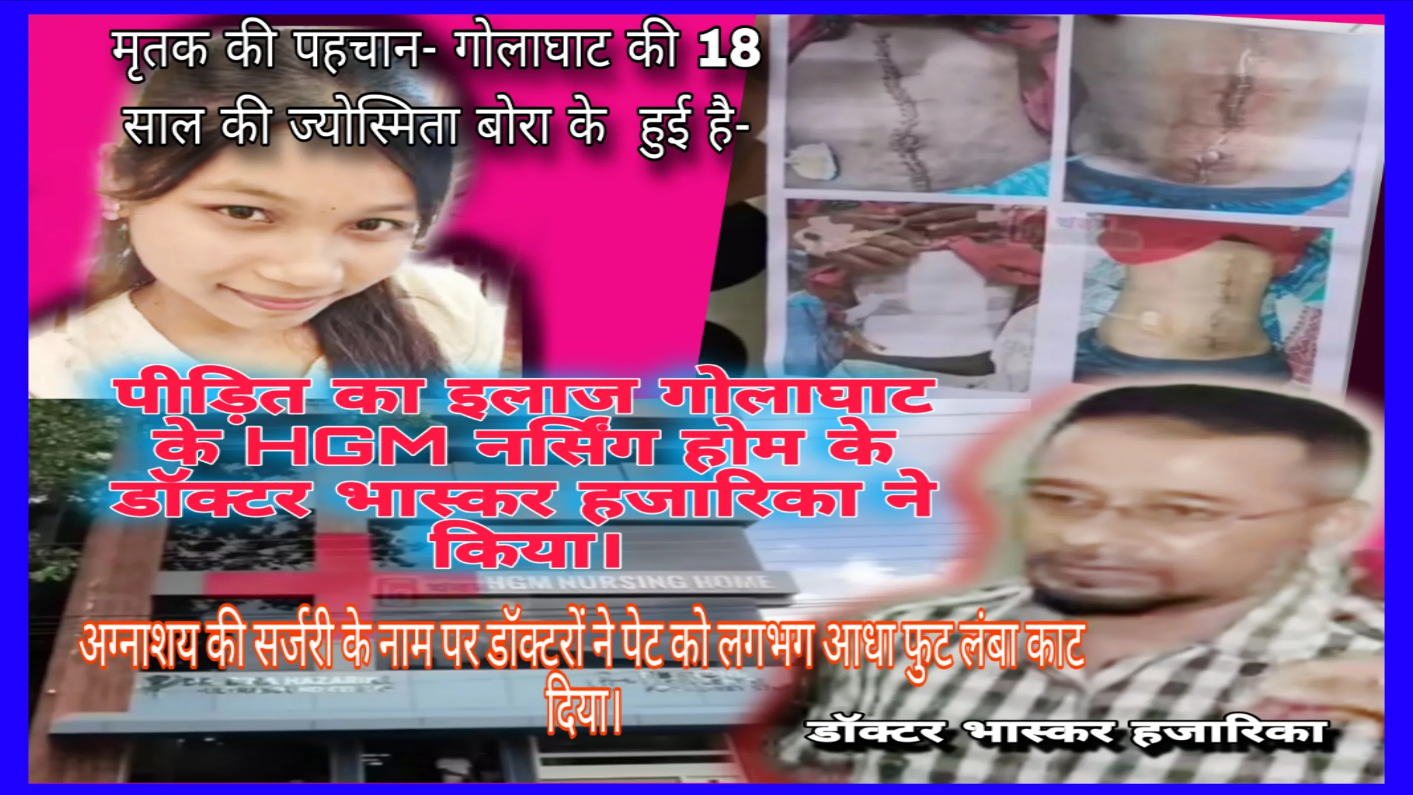 गॉल ब्लैडर सर्जरी के दौरान शरीर को पोस्टमॉर्टम की तरह काटा गया है-