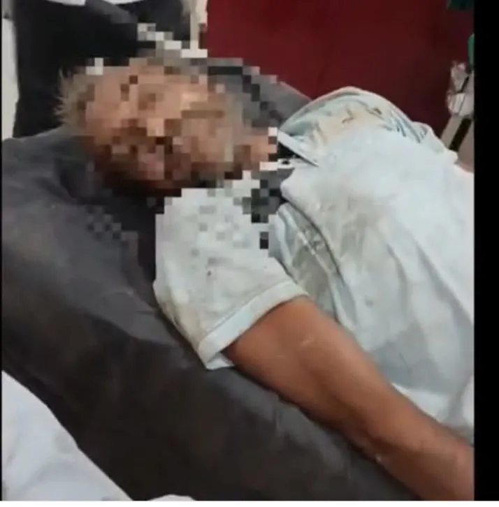 देवरिया में सड़क हादसे में किसान की मौत: बाजार जाते समय अज्ञात वाहन ने मारी टक्कर, पुलिया के पास मिला शव