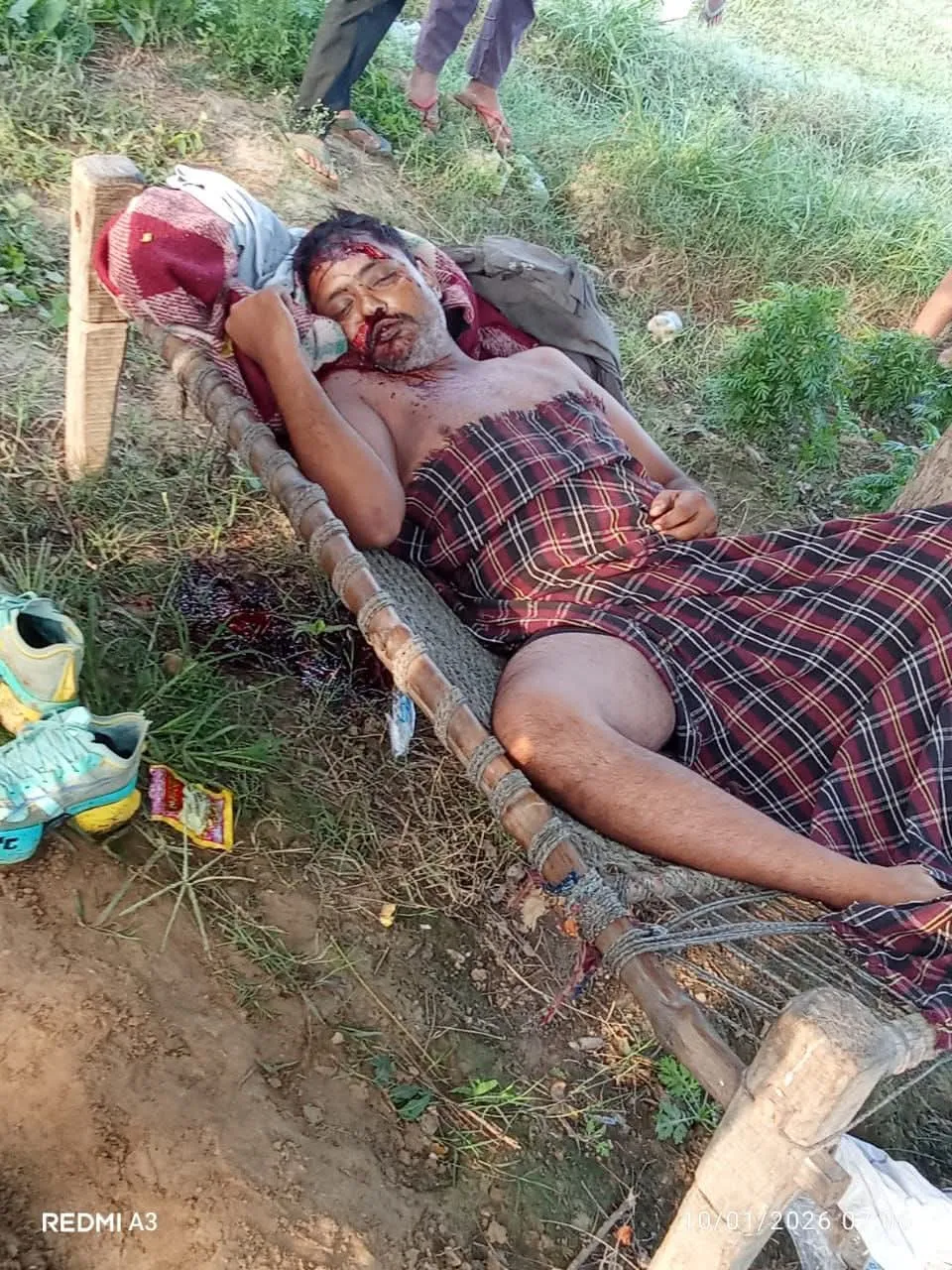 ब्रेकिंग न्यूज आगरा में खेत पर चारपाई पर सो रहे हिस्ट्रीशीटर की निर्मम हत्या, सिर पर धारदार हथियार से किया हमला