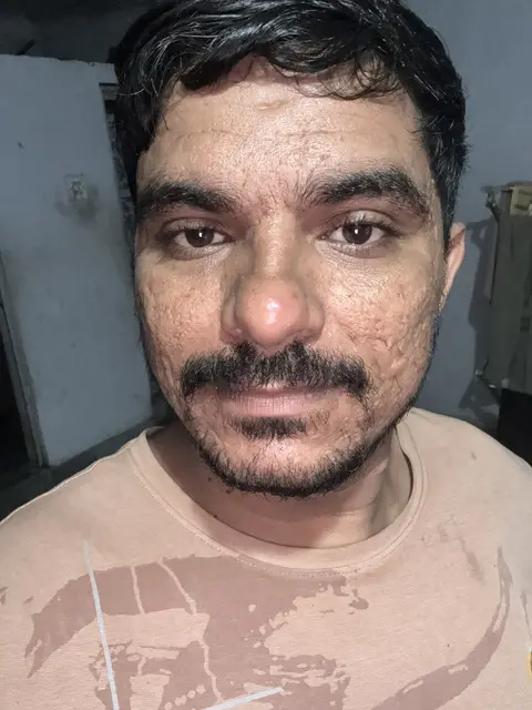 Mukesh Ramprasad Kumawat