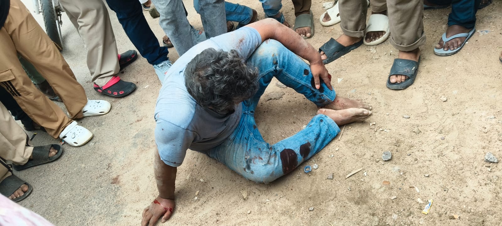 काशीराम मोड़ पर युवक से मारपीट, घायल हालत में छोड़कर भागे कार सवार उन्नाव सदर कोतवाली क्षेत्र के काशीराम मोड़ के पास अज्ञात कार सवारों ने एक युवक को अपने साथ बैठाकर ले जाने के बाद मारपीट की। घायल युवक को सड़क किनारे छोड़कर आरोपी फरार हो गए। आसपास के लोगों ने पुलिस को सूचना दी। पुलिस मामले की जांच में जुटी है।
