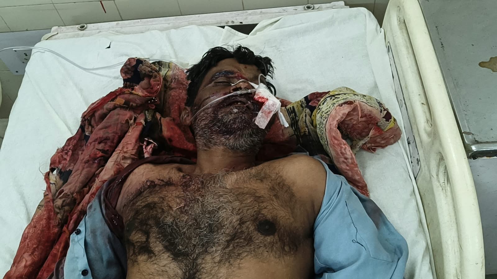 उन्नाव में बाइक सवार तीन युवकों ने व्यक्ति को मारी गोली उन्नाव के सोहरामऊ क्षेत्र में शनिवार देर रात कन्हैयालाल (45) को गोली मार दी गई। जबड़े में गोली लगने से वह गंभीर घायल हो गए। जिला अस्पताल से कानपुर हैलट रेफर किया गया। पुलिस ने तीन नामजद आरोपियों पर मुकदमा दर्ज कर दो लोगों को हिरासत में लिया है। शुरुआती जांच में पैसों के लेन-देन का विवाद सामने आया है।